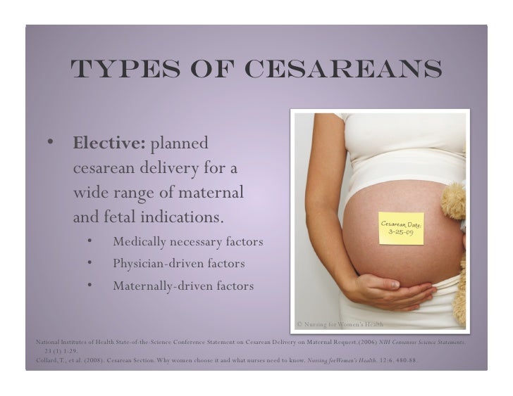 Babies On Demand Cesarean Delivery by Maternal Request