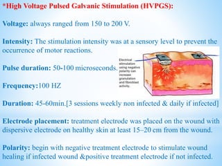 *High Voltage Pulsed Galvanic Stimulation (HVPGS):
Voltage: always ranged from 150 to 200 V.
Intensity: The stimulation intensity was at a sensory level to prevent the
occurrence of motor reactions.
Pulse duration: 50-100 microseconds.
Frequency:100 HZ
Duration: 45-60min.[3 sessions weekly non infected & daily if infected]
Electrode placement: treatment electrode was placed on the wound with
dispersive electrode on healthy skin at least 15–20 cm from the wound.
Polarity: begin with negative treatment electrode to stimulate wound
healing if infected wound &positive treatment electrode if not infected.
 