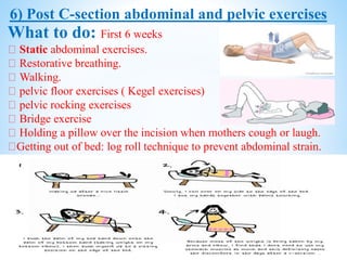 6) Post C-section abdominal and pelvic exercises
What to do: First 6 weeks
Static abdominal exercises.
Restorative breathing.
Walking.
pelvic floor exercises ( Kegel exercises)
pelvic rocking exercises
Bridge exercise
Holding a pillow over the incision when mothers cough or laugh.
Getting out of bed: log roll technique to prevent abdominal strain.
 