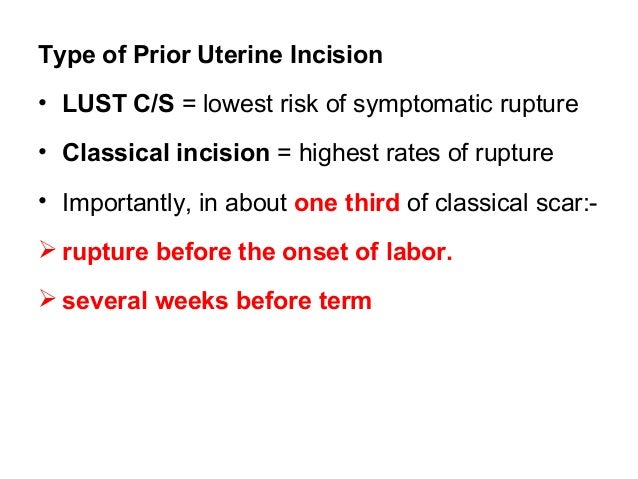 Cesarean Delivery cesarean-delivery