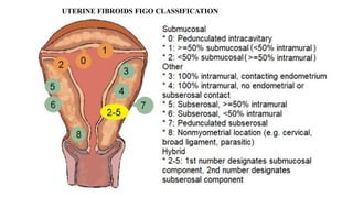 Myome Classification CEASAREAN DELIVERY POST MYOMECTOMY. pptx | PPTX