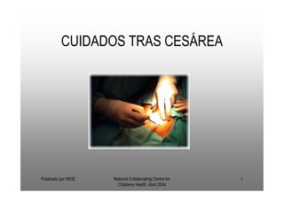 CUIDADOS TRAS CESÁREA




Publicado por NICE   National Collaborating Centre for   1
                       Childrens Health. Abril 2004
 