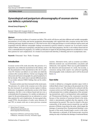 Vol.:(0123456789)1 3
Journal of Ultrasound
https://doi.org/10.1007/s40477-019-00403-3
PICTORIAL ESSAY
Gynecological and postpartum ultrasonography of cesarean uterine
scar defects: a pictorial essay
Ahmed Samy El Agwany1
 
Received: 19 March 2019 / Accepted: 29 July 2019
© Società Italiana di Ultrasonologia in Medicina e Biologia (SIUMB) 2019
Abstract
There is an increasing incidence of cesarean scar defect. This article will discuss and show different and variable sonographic
presentations of scar niches and uterine postpartum ultrasonography with vaginal birth after cesarean section that can be
confusing and many should be unaware of. This brief review aims to help practitioners to avoid confusion and be aware and
acquainted with the different sonographic findings encountered in practice related to cesarean scar. It can lead to uterine
rupture I labour, dehiscence in pregnancy and placenta accreta in the future pregnancy, but this is not evidence-based and not
even a contraindication for pregnancy. It is neither an indication of repair for the presenting patient nor an indication to screen
these patients for such complications. It is treated if associated with infertility or bleeding and not in asymptomatic ones.
Keywords  Ultrasound · Scar · Niche · Cesarean
Introduction
Cesarean section (CS) niche describes the presence of a
hypoechoic area within the myometrium in the isthmus, with
the discontinuation of the myometrium at the site of a pre-
vious CS. Uterine scar defects or scar niches are relatively
common after cesarean delivery. Uterine scar imaging with
ultrasound and hysterosonography has gained popularity in
the last decade. This article aims to present different pictures
of scar niches and post-VBAC findings that can be confus-
ing [1, 2].
Cesarean section cases have increased in the recent years.
The presence of a niche in the cesarean scar in the uterus
has also increased. It can lead to uterine rupture in labour,
dehiscence in pregnancy and placenta accreta in the future
pregnancy, but this is not evidence-based and not even a
contraindication for pregnancy. It is neither an indication of
repair for the presenting patient nor an indication to screen
these patients for such complications. In transvaginal ultra-
sound (TVS), the prevalence of niche varies between 42
and 70% in women with one or more previous cesarean
sections. Alternative terms, such as cesarean scar defect,
deficient cesarean scar, scar diverticulum, scar pouch, and
isthmocele, were reported. There was no gold standard for
the detection and measurement of a niche, but recently, a
consensus among niche experts was achieved regarding
ultrasonographic niche evaluation and it will be discussed
below [1].
Scar niche
A niche is defined as a triangular anechoic space (with or
without fluid) at least 2 mm deep at the presumed site of the
cesarean section scar. This should not be confused with the
cesarean section scar itself that appears as an echogenic line
at the presumed site or similar echogenicity of the surround-
ing myometrium, and it is not hypoechoic unless pathologi-
cal. Postmenstrual bleeding is the commonest complaint
because of the retention of menstrual blood in the niche,
which is intermittently expelled after the majority of the
menstruation has passed. This may be related to the poor
contractility of the uterine muscle around the scar and the
presence of fibrotic tissue below the niche, which impair the
drainage of menstrual flow. Postmenstrual bleeding is also
because of the newly formed fragile vessels in the niche.
This represents a rationale of the hysteroscopic resection
aiming not only to facilitate the drainage of menstrual blood,
*	 Ahmed Samy El Agwany
	Ahmedsamyagwany@gmail.com;
ahmed.elagwany@alexmed.edu.eg
1
	 Department of Obstetrics and Gynecology, Faculty
of Medicine, Alexandria University, Alexandria, Egypt
 