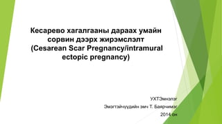 Кесарево хагалгааны дараах умайн
сорвин дээрх жирэмслэлт
(Cesarean Scar Pregnancy/intramural
ectopic pregnancy)
УХТЭмнэлэг
Эмэгтэйчүүдийн эмч Т. Баярчимэг
2014 он
 