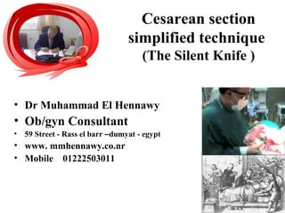 Cesarean section
simplified technique
(The Silent Knife )
• Dr Muhammad El Hennawy
• Ob/gyn Consultant
• 59 Street - Rass el barr –dumyat - egypt
• www. mmhennawy.co.nr
• Mobile 01222503011
 