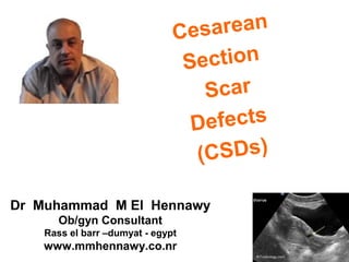 Cesarean
Section
Scar
Defects
(CSDs)
Dr Muhammad M El Hennawy
Ob/gyn Consultant
Rass el barr –dumyat - egypt
www.mmhennawy.co.nr
 