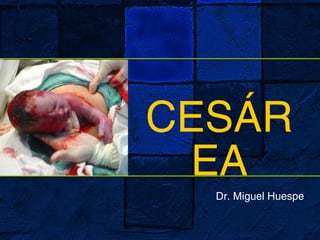 CESÁR
EA
Dr. Miguel Huespe
 