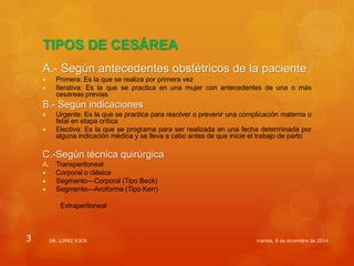 Cesárea segura ppt | PPTX