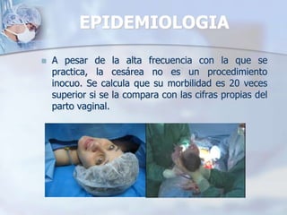 EPIDEMIOLOGIAA pesar de la alta frecuencia con la que se practica, la cesárea no es un procedimiento inocuo. Se calcula que su morbilidad es 20 veces superior si se la compara con las cifras propias del parto vaginal.