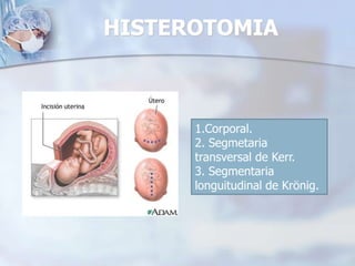 hidrocefalia, mielomeningocele, onfalocele, ascitis fetal,