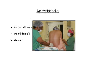 Anestesia Raquidiana Peridural Geral 
