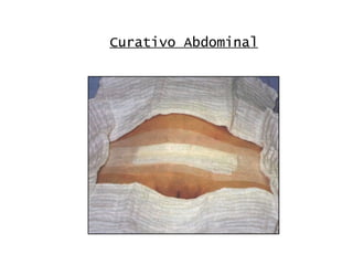 Curativo Abdominal 