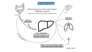 CRC: pattern of spread
Harrison’s, 19th Ed.
Most recurrences occur within 4 years of surgery
At least 12 lymph nodes need to be evaluated to establish prognosis
TNM/Stage is prognostic
Regional
lymph nodes
Supraclavicular
lymph nodes
Liver metastases
Initial site of spread in 1/3
Involved at death in 2/3
Median survival of metastatic CRC is
improving: about 2-3 years (2020)
 