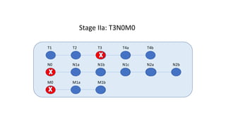T1 T2 T3 T4a T4b
N0 N1a N1b N1c N2a N2b
M0 M1a M1b
Stage IIa: T3N0M0
 