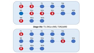 T1 T2 T3 T4a T4b
N0 N1a N1b N1c N2a N2b
M0 M1a M1b
T1 T2 T3 T4a T4b
N0 N1a N1b N1c N2a N2b
M0 M1a M1b
Stage IIIa: T1-2N1a-cM0, T1N2aM0
 