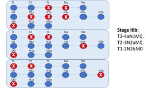 T1 T2 T3 T4a T4b
N0 N1a N1b N1c N2a N2b
M0 M1a M1b
T1 T2 T3 T4a T4b
N0 N1a N1b N1c N2a N2b
M0 M1a M1b
T1 T2 T3 T4a T4b
N0 N1a N1b N1c N2a N2b
M0 M1a M1b
Stage IIIb:
T3-4aN1M0,
T2-3N2aM0,
T1-2N2bM0
 