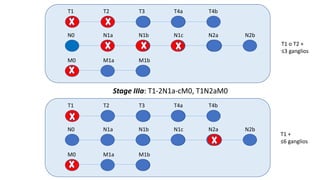 T1 T2 T3 T4a T4b
N0 N1a N1b N1c N2a N2b
M0 M1a M1b
T1 T2 T3 T4a T4b
N0 N1a N1b N1c N2a N2b
M0 M1a M1b
Stage IIIa: T1-2N1a-cM0, T1N2aM0
T1 o T2 +
≤3 ganglios
T1 +
≤6 ganglios
 