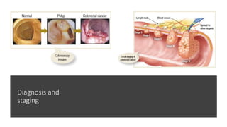 Diagnosis and
staging
 