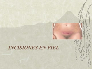 INCISIONES EN PIEL 