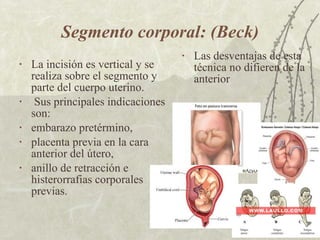 Segmento corporal: (Beck) La incisión es vertical y se realiza sobre el segmento y parte del cuerpo uterino. Sus principales indicaciones son:  embarazo pretérmino,  placenta previa en la cara anterior del útero,  anillo de retracción e histerorrafias corporales previas.  Las desventajas de esta técnica no difieren de la  anterior 