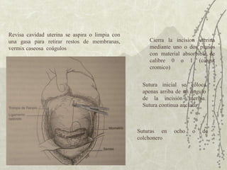Revisa cavidad uterina se aspira o limpia con una gasa para retirar restos de membranas, vermix caseosa  coágulos Cierra la incision uterina mediante uno o dos planos con material absorbible de calibre 0 o 1 (catgut cromico) Sutura inicial se coloca apenas arriba de un ángulo de la incisión uterina. Sutura continua anclada  Suturas en ocho o de colchonero  