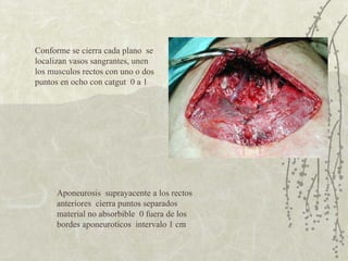 Conforme se cierra cada plano  se localizan vasos sangrantes, unen los musculos rectos con uno o dos puntos en ocho con catgut  0 a 1  Aponeurosis  suprayacente a los rectos anteriores  cierra puntos separados  material no absorbible  0 fuera de los bordes aponeuroticos  intervalo 1 cm 