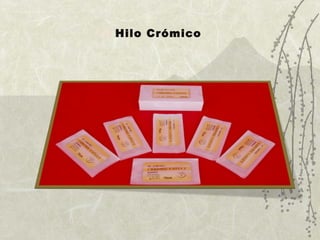 Hilo Crómico 