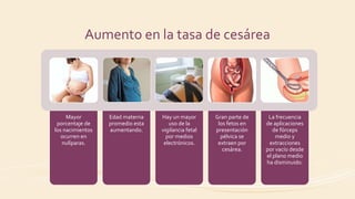 Aumento en la tasa de cesárea
Mayor
porcentaje de
los nacimientos
ocurren en
nulíparas.
Edad materna
promedio esta
aumentando.
Hay un mayor
uso de la
vigilancia fetal
por medios
electrónicos.
Gran parte de
los fetos en
presentación
pélvica se
extraen por
cesárea.
La frecuencia
de aplicaciones
de fórceps
medio y
extracciones
por vacío desde
el plano medio
ha disminuido.
 