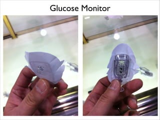 Glucose Monitor

 