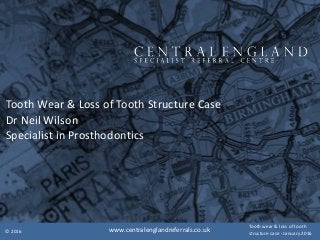 Tooth	Wear	&	Loss	of	Tooth	Structure	Case	
Dr	Neil	Wilson	
Specialist	in	Prosthodontics	
©	2016
Tooth	wear	&	loss	of	tooth	
structure	case	-	January	2016www.centralenglandreferrals.co.uk
 
