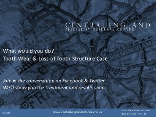 What	would	you	do?	
Tooth	Wear	&	Loss	of	Tooth	Structure	Case	
Join	in	the	conversation	on	Facebook	&	Twitter	
We’ll	show	you	the	treatment	and	results	soon
©	2015
Tooth	Wear	&	loss	of	tooth	
structure	case	-	Nov	‘15www.centralenglandreferrals.co.uk
 