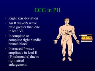ECG in PH
• Right axis deviation
• An R wave/S wave
ratio greater than one
in lead V1
• Incomplete or
complete right bundle
branch block
• Increased P wave
amplitude in lead II
(P pulmonale) due to
right atrial
enlargement
 