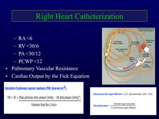 Right Heart Catheterization
•
•
– RA <6
– RV <30/6
– PA <30/12
– PCWP <12
Pulmonary Vascular Resistance
Cardiac Output by the Fick Equation
 