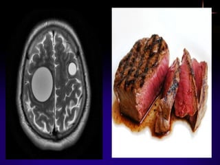 Powerpoint presentation forr Cestoda.pdf