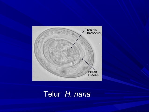 100+ Gambar Telur Cacing Cestoda Paling Hist 100+ Gambar Telur Cacing Cestoda Paling Hist