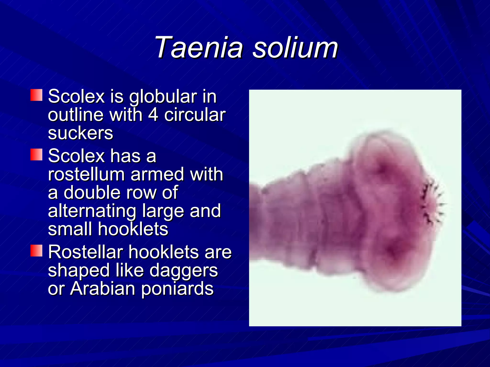 Taenia solium
Scolex is globular in
outline with 4 circular
suckers
Scolex has a
rostellum armed with
a double row of
alternating large and
small hooklets
Rostellar hooklets are
shaped like daggers
or Arabian poniards
 
