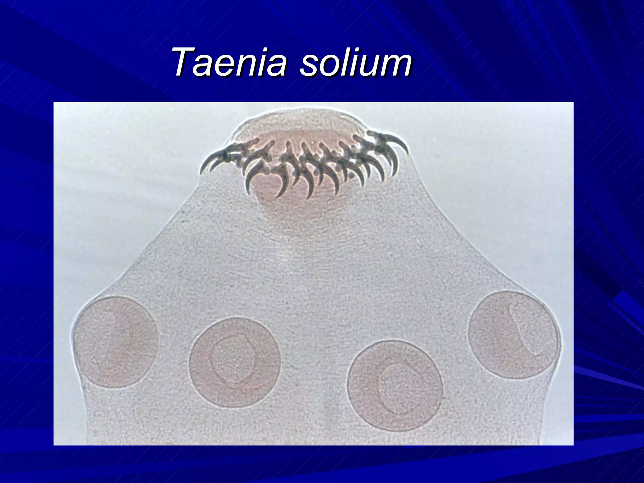 Taenia solium
 
