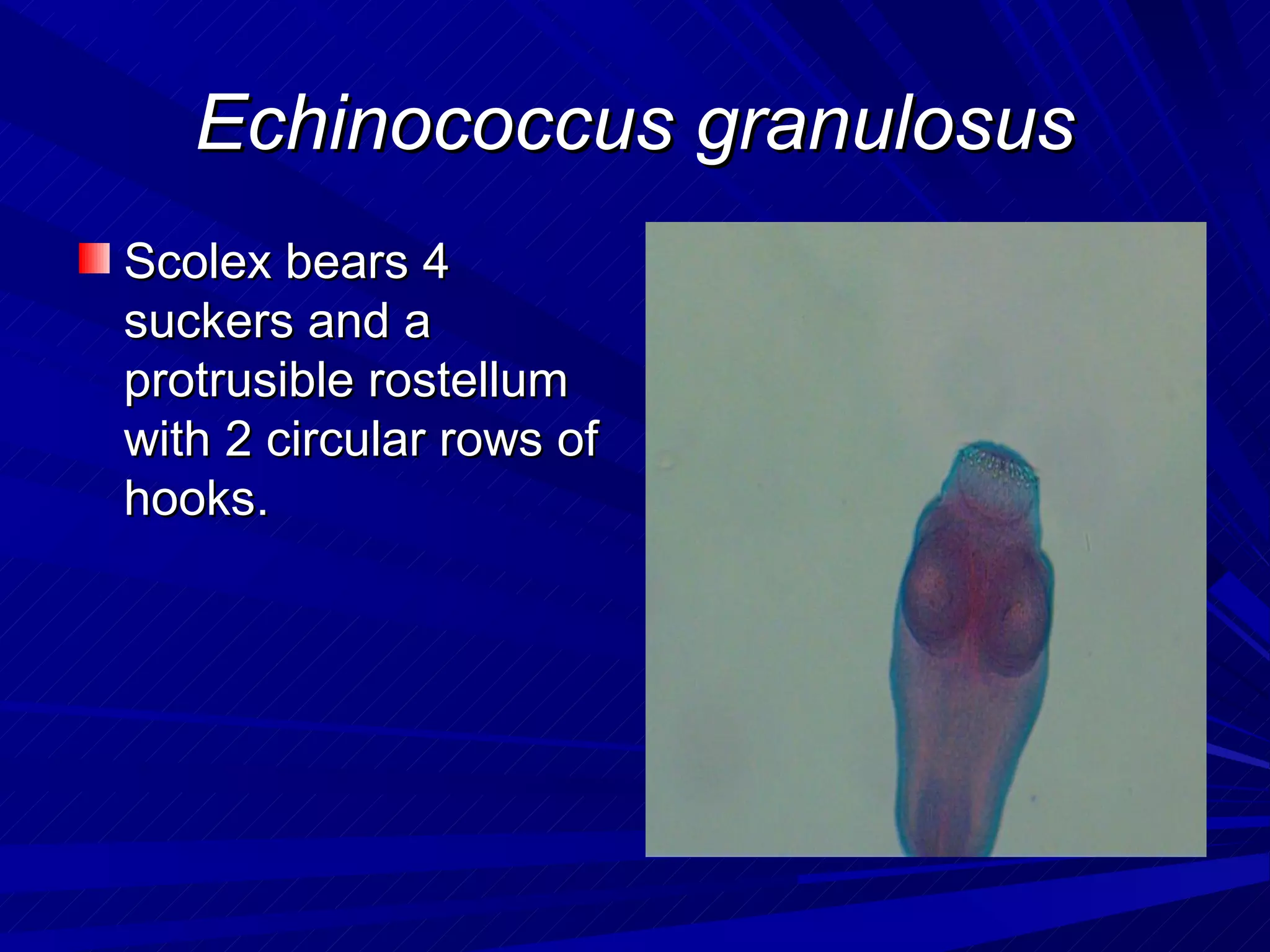 Echinococcus granulosus
Scolex bears 4
suckers and a
protrusible rostellum
with 2 circular rows of
hooks.
 