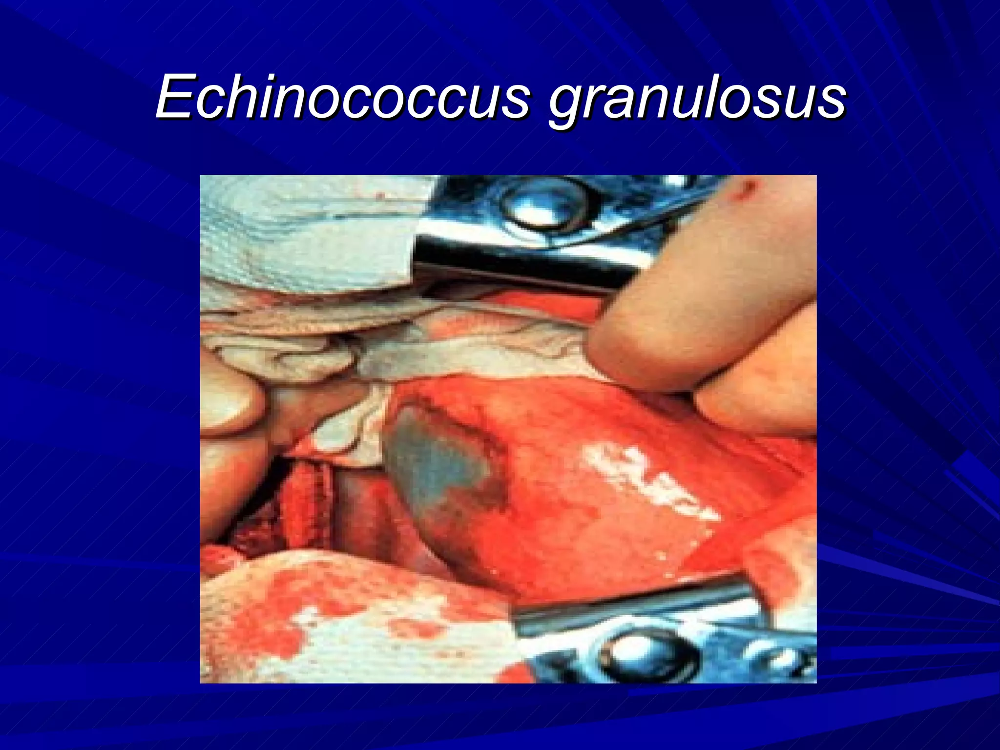 Echinococcus granulosus
 