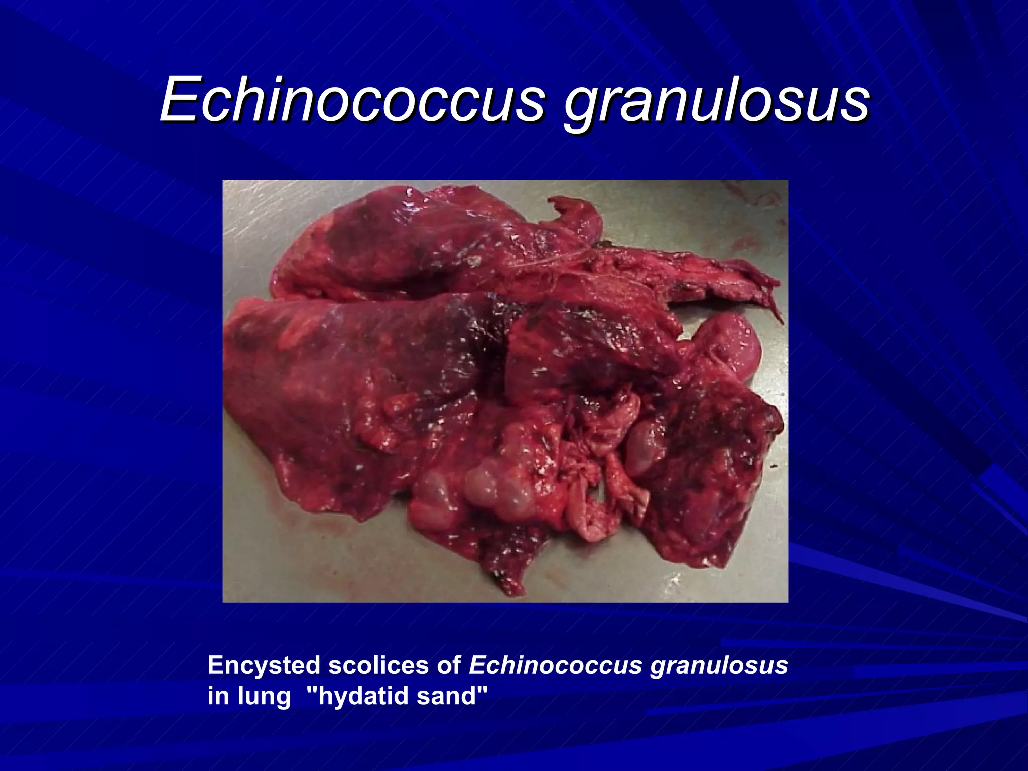 Echinococcus granulosus




 Encysted scolices of Echinococcus granulosus
 in lung "hydatid sand"
 