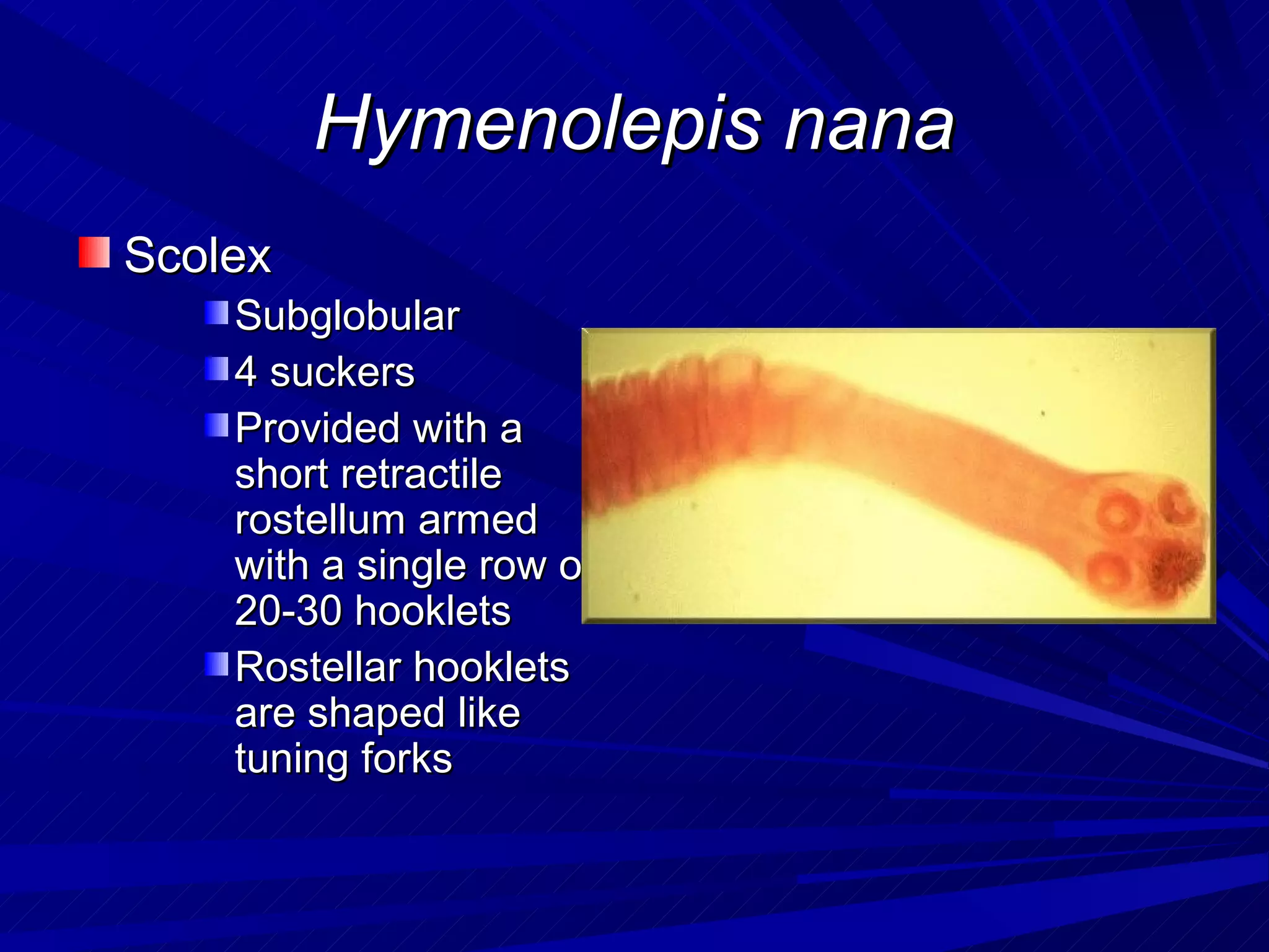 Hymenolepis nana
Scolex
    Subglobular
    4 suckers
    Provided with a
    short retractile
    rostellum armed
    with a single row of
    20-30 hooklets
    Rostellar hooklets
    are shaped like
    tuning forks
 