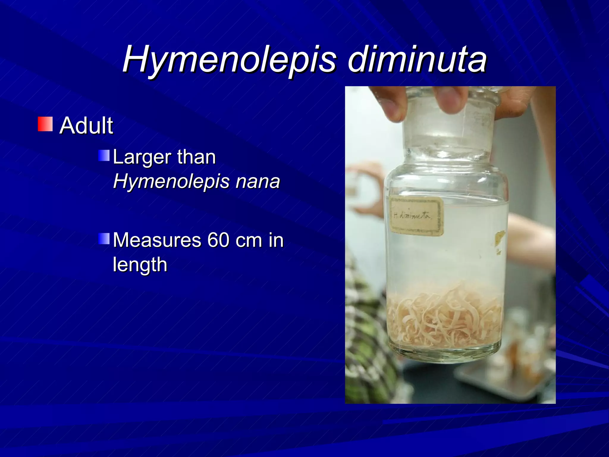 Hymenolepis diminuta
Adult
    Larger than
    Hymenolepis nana

    Measures 60 cm in
    length
 