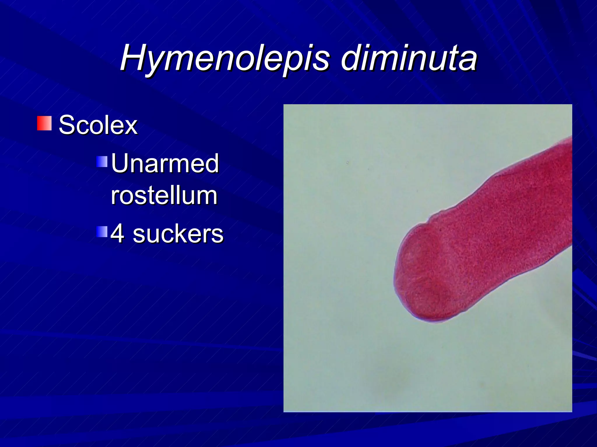 Hymenolepis diminuta
Scolex
    Unarmed
    rostellum
    4 suckers
 