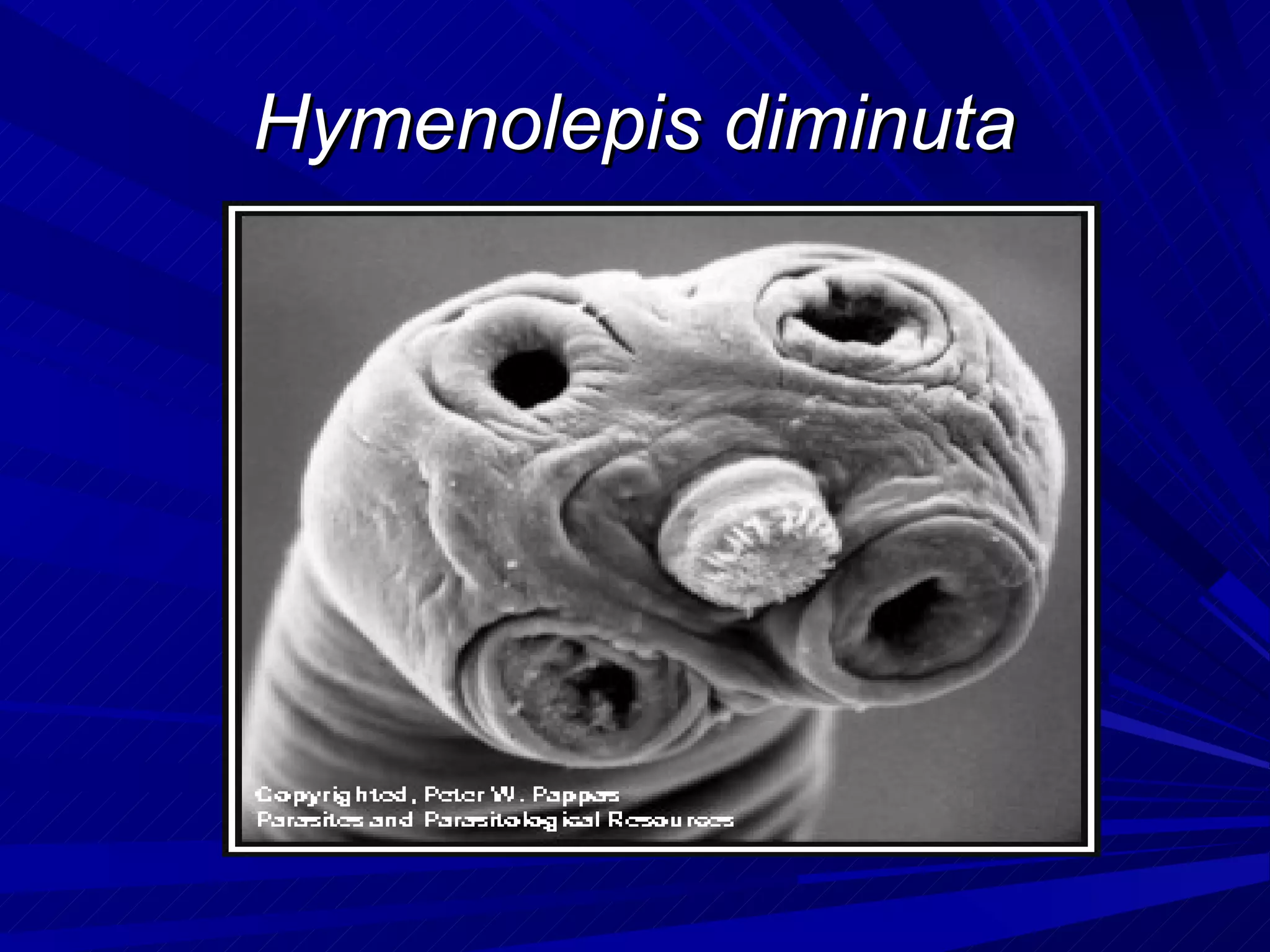 Hymenolepis diminuta
 