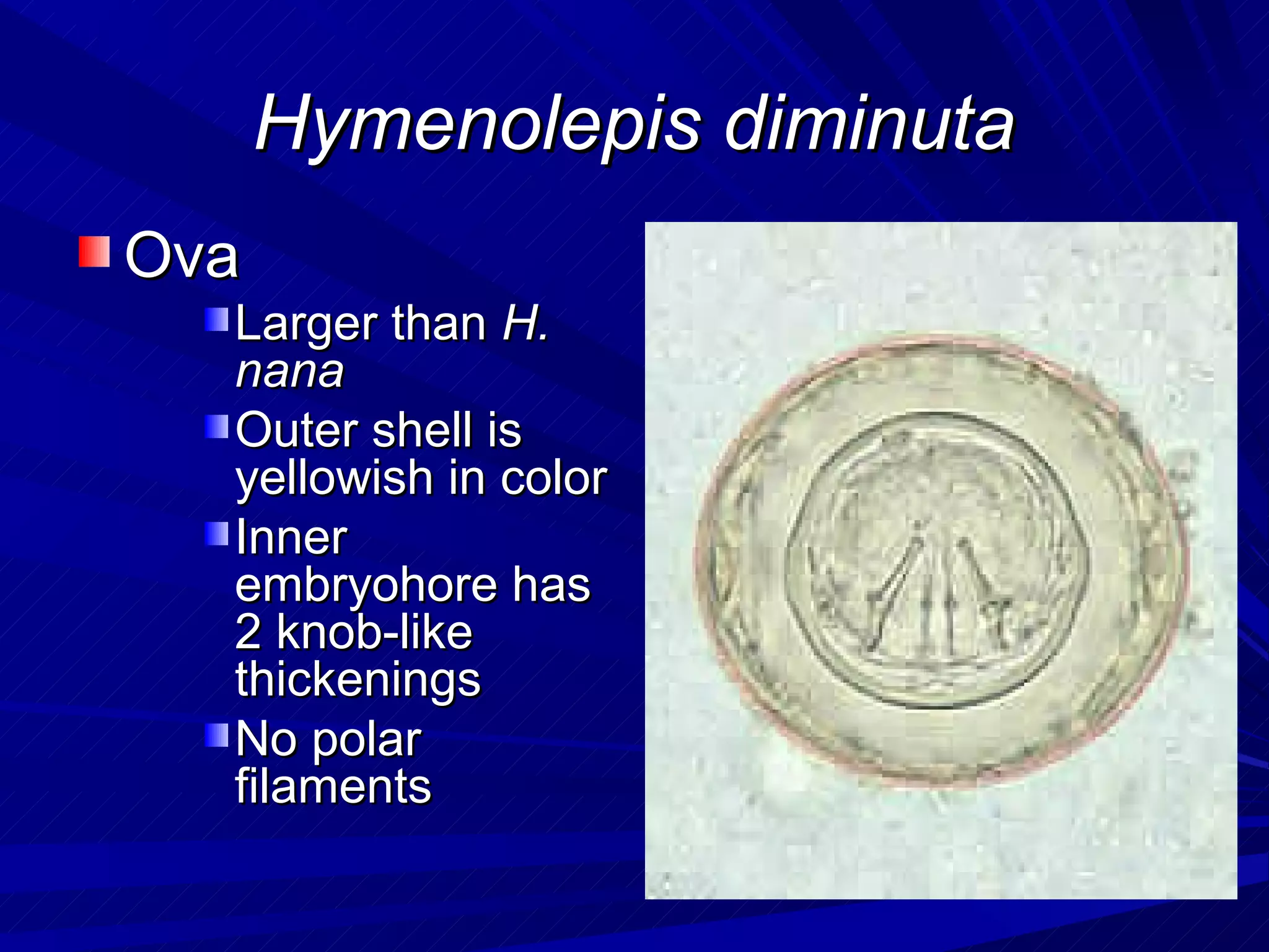 Hymenolepis diminuta
Ova
  Larger than H.
  nana
  Outer shell is
  yellowish in color
  Inner
  embryohore has
  2 knob-like
  thickenings
  No polar
  filaments
 