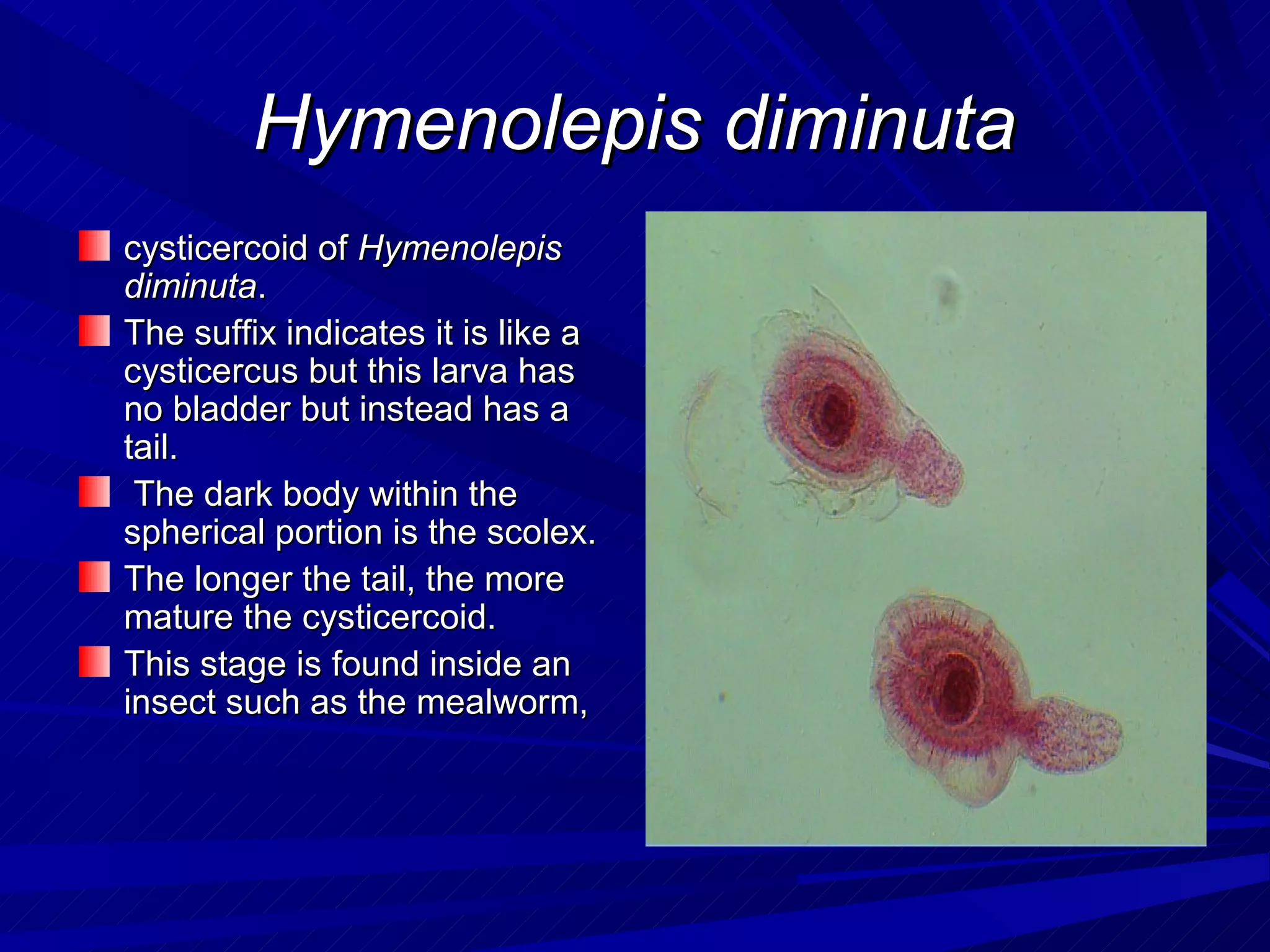 Hymenolepis diminuta
cysticercoid of Hymenolepis
diminuta.
The suffix indicates it is like a
cysticercus but this larva has
no bladder but instead has a
tail.
 The dark body within the
spherical portion is the scolex.
The longer the tail, the more
mature the cysticercoid.
This stage is found inside an
insect such as the mealworm,
 