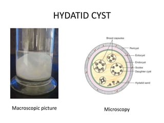 Cestodes | PPTX