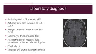 Laboratory diagnosis
 Radiodiagnosis - CT scan and MRI
 Antibody detection in serum or CSF -
ELISA
 Antigen detection in serum or CSF -
ELISA
 Lymphocyte transformation test
 Histopathology of muscles, eyes,
subcutaneous tissues or brain biopsies
 FNAC of cyst
 Modified Del Brutto diagnostic criteria
 