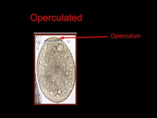 Operculated Shape Cestodes by Dr. KennedyMunisi MD. MMed. Msc.ppt
