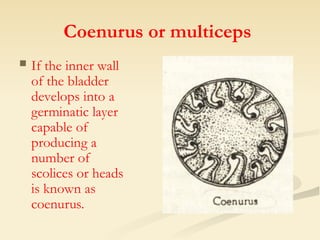 Cestodes-LEC 2025.ppt hshywuhwwhhsbsjajqiusdbsnjawjejduhdhshsjsh | PPT
